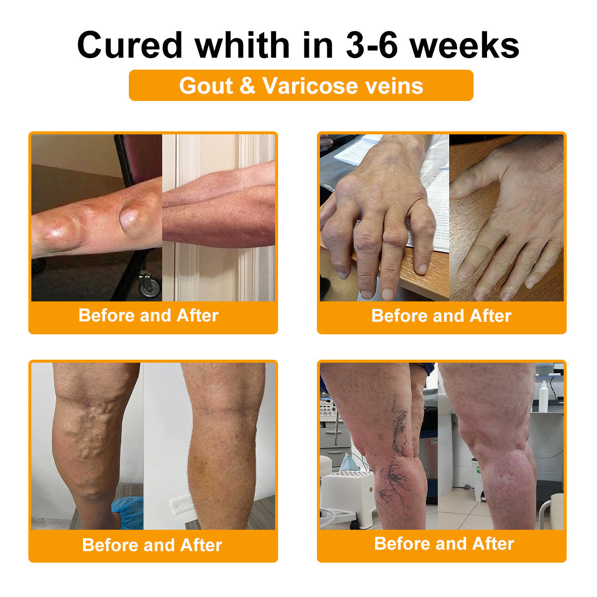 ADNOON® Botulinum Toxin & Bee Venom Pain-Relief Bone Healing Cream