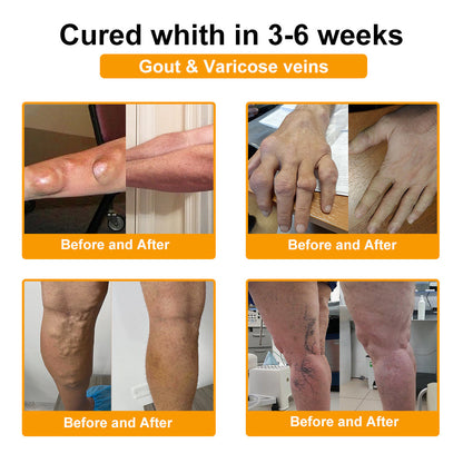 ADNOON® Botulinum Toxin & Bee Venom Pain-Relief Bone Healing Cream
